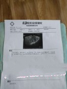 46岁广州孟女士移植XY囊胚成功妊娠