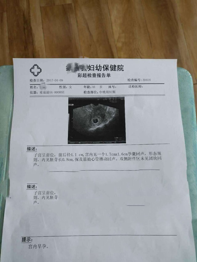 46岁广东X女士移植XY囊胚成功妊娠