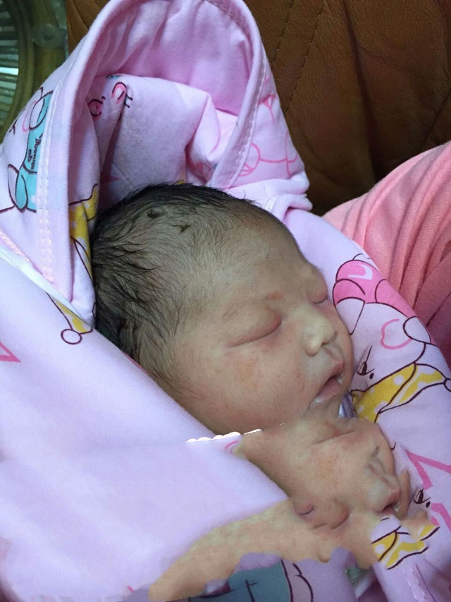 广州李先生夫妇自卵助孕顺利生产