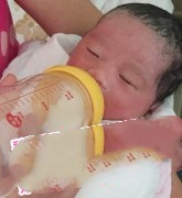 输卵管积水导致不孕 试管婴儿来助她成功产子