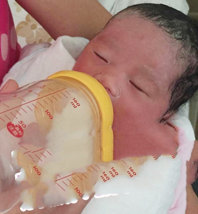 输卵管积水导致不孕 试管婴儿来助她成功产子