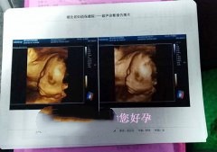 广东Z女士的包男孩 广州代妈 求子记