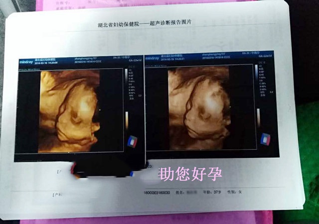 广东Z女士的包男孩