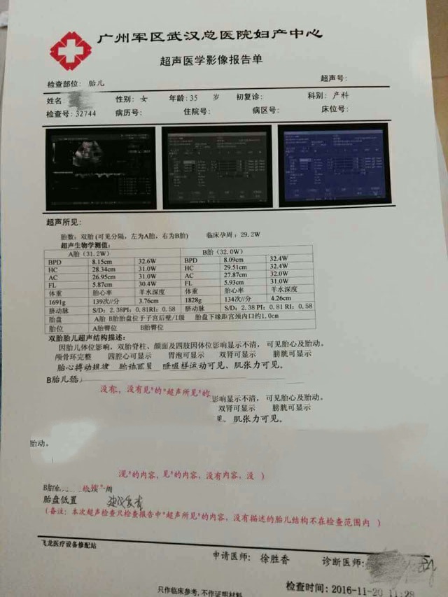 巧克力囊肿患者助孕 龙凤胎诞生记