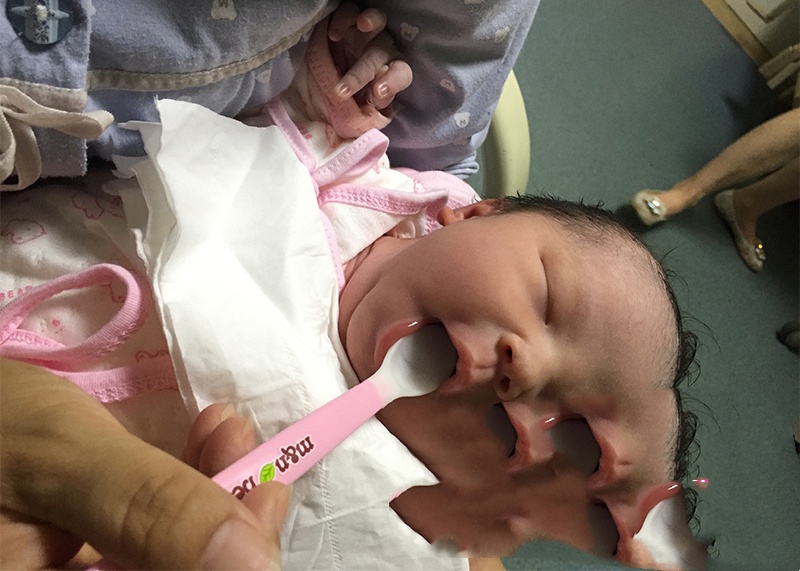 弱精男士多年无子 最终赴美试管成功